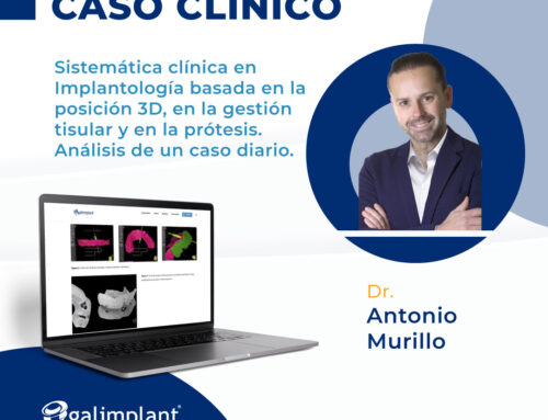 Caso clínico | Sistemática clínica en implantología basada en la posición 3D, en la gestión tisular y en la prótesis